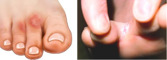 13.png